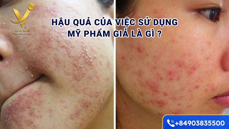 Hậu quả của việc sử dụng mỹ phẩm giả